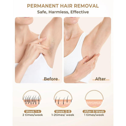 IPL Hair Removal Device 999,900 Flashes Dual Mode by HitMyNeed