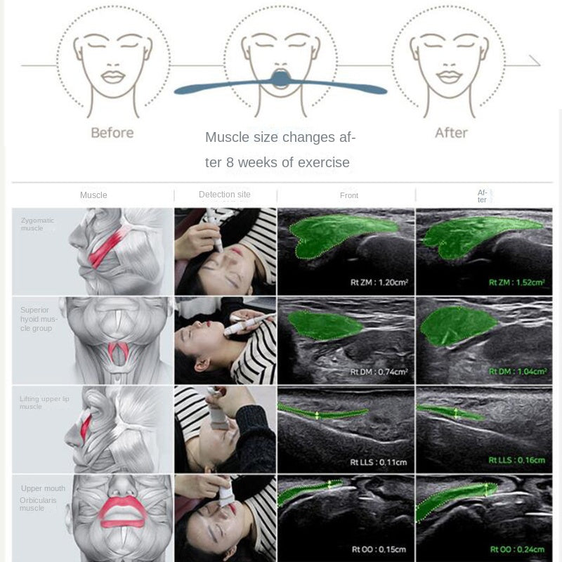 Jaw Exerciser Double Chin & Jawline Trainer by HitMyNeed
