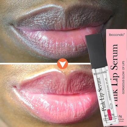 Korean Lip Serum for Moisture, Smoothness & Tone by HitMyNeed