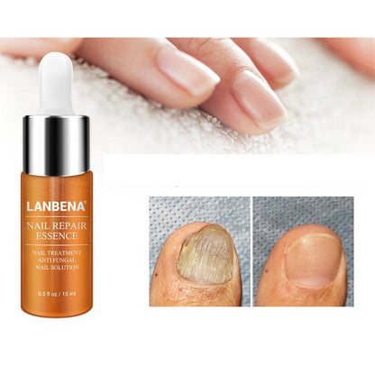 Labrena Nail Fungus Treatment Serum 12ml by HitMyNeed