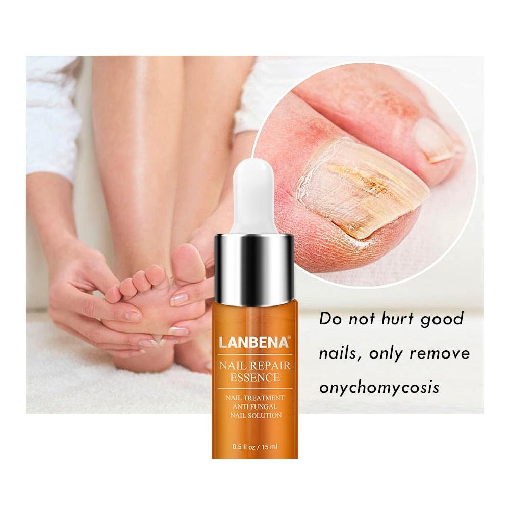 Labrena Nail Fungus Treatment Serum 12ml by HitMyNeed