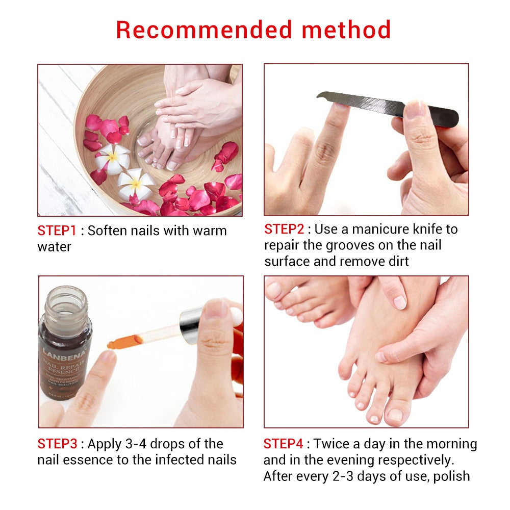 Labrena Nail Fungus Treatment Serum 12ml by HitMyNeed