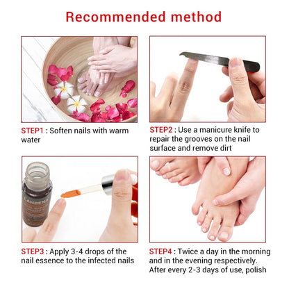 Labrena Nail Fungus Treatment Serum 12ml by HitMyNeed