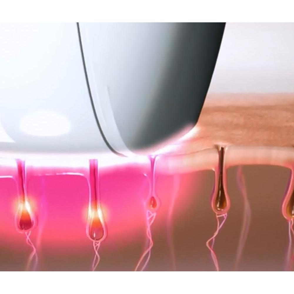 Laser Epilation Permanent Hair Removal Device by HitMyNeed