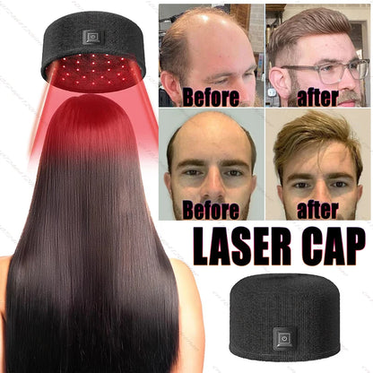 Laser Hair Growth Cap with Heat & Scalp Massage by HitMyNeed