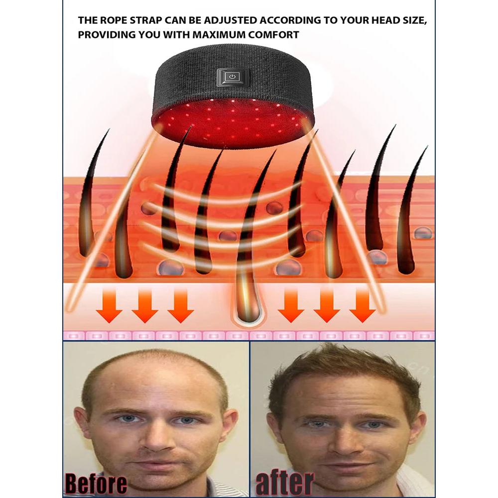 Laser Hair Growth Cap with Heat & Scalp Massage by HitMyNeed