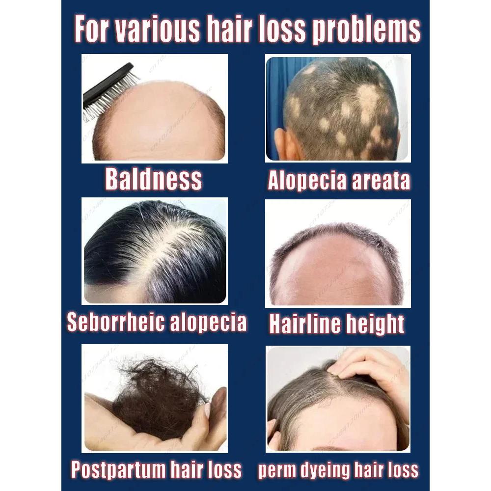 Laser Hair Growth Cap with Heat & Scalp Massage by HitMyNeed