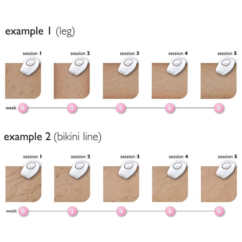 Laser Hair Removal Pro Epilator Device by HitMyNeed