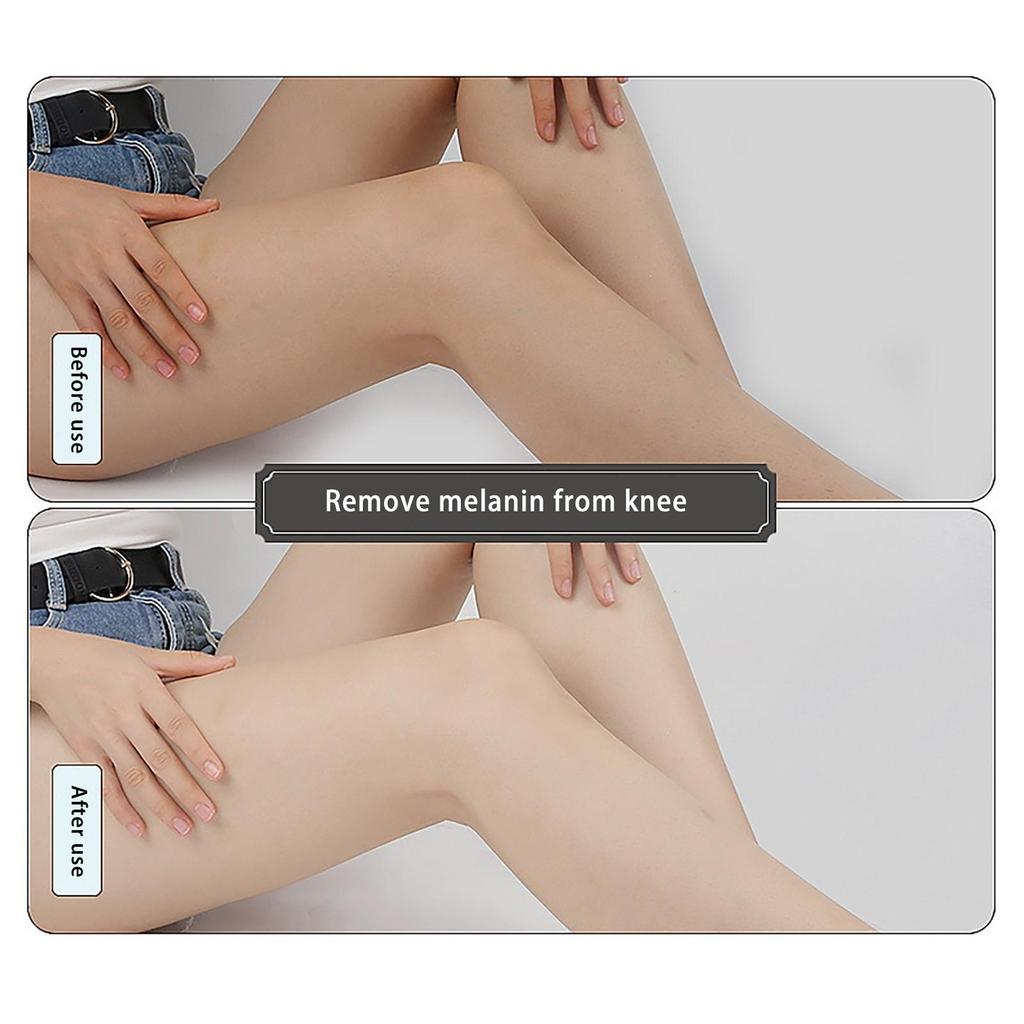Magic Whitening Cream for Underarms, Knees & Inner Thighs by HitMyNeed