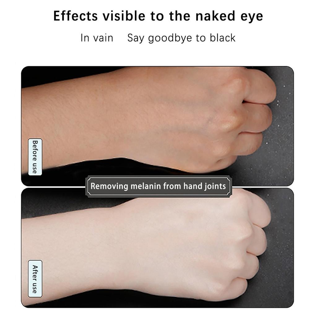 Magic Whitening Cream for Underarms, Knees & Inner Thighs 50g by HitMyNeed