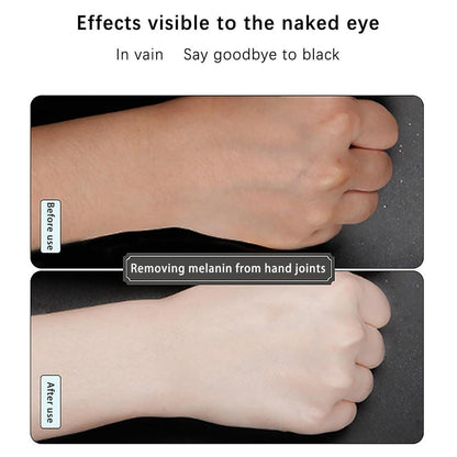 Magic Whitening Cream for Underarms, Knees & Inner Thighs 50g by HitMyNeed