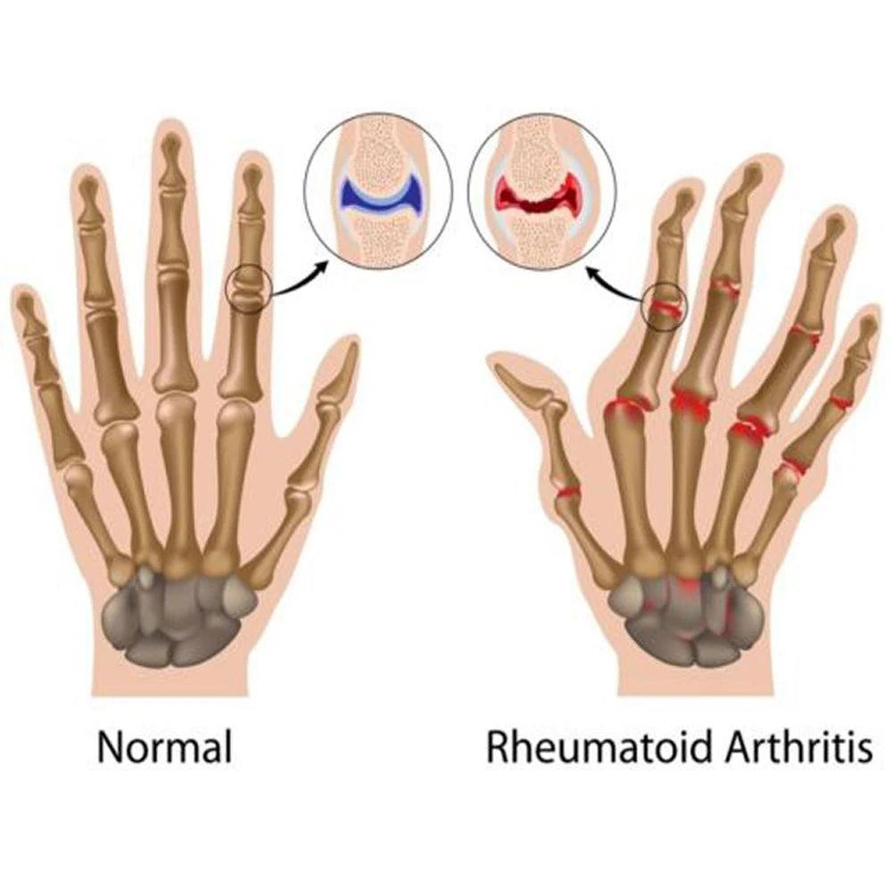 Magnetic Therapy Fingerless Compression Gloves by HitMyNeed
