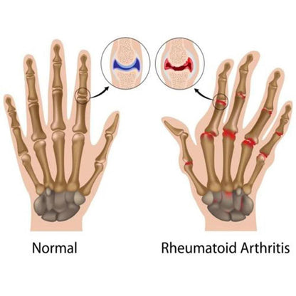 Magnetic Therapy Fingerless Compression Gloves by HitMyNeed