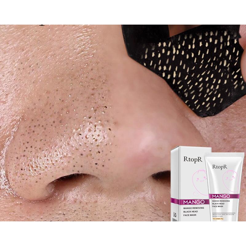 Mango Blackhead Extraction Peel-Off Mask 50g by HitMyNeed