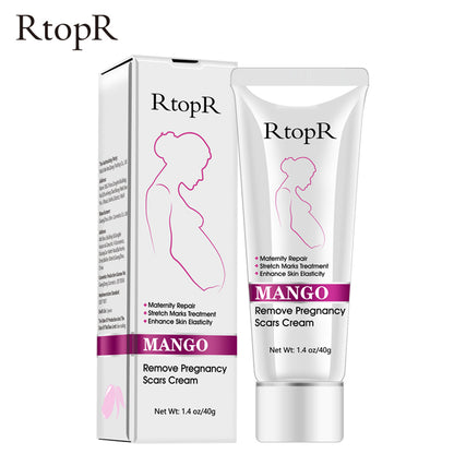 Mango Stretch Mark Cream for Pregnancy 40g by HitMyNeed