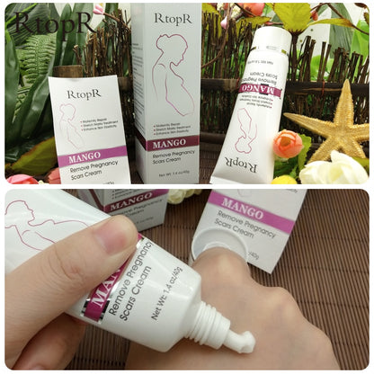 Mango Stretch Mark Cream for Pregnancy 40g by HitMyNeed