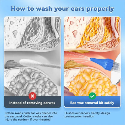 Manual Ear Irrigation Earwax Removal Cleaning Kit by HitMyNeed