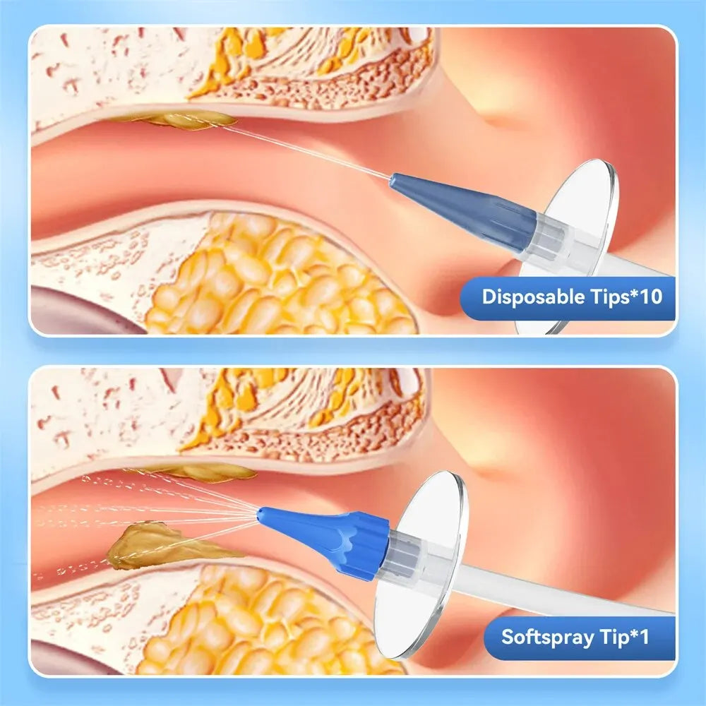 Manual Ear Irrigation Earwax Removal Cleaning Kit by HitMyNeed