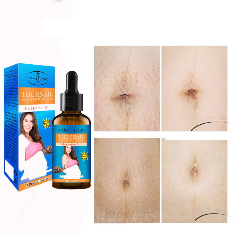 Maternity Stretch Mark Repair Essential Oil by HitMyNeed