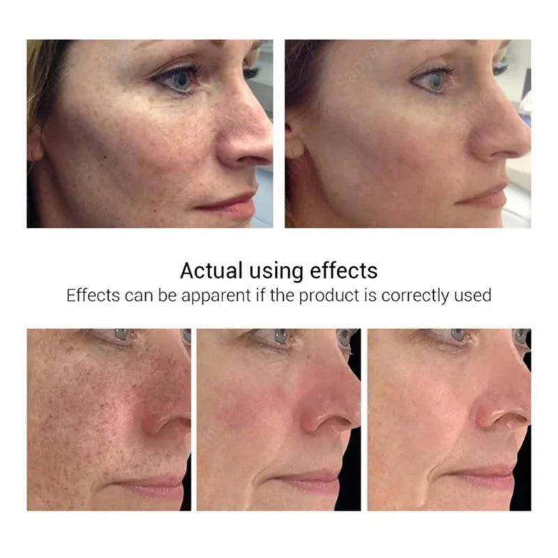 Melasma & Dark Spot Correcting Face Cream by HitMyNeed