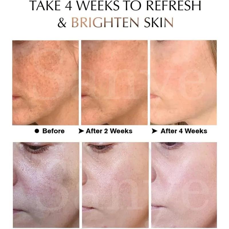 Melasma & Dark Spot Correcting Face Cream by HitMyNeed