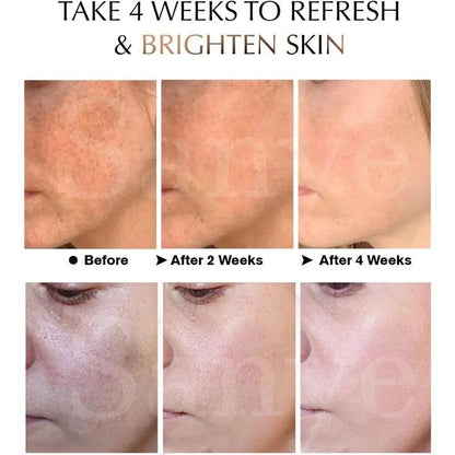 Melasma & Dark Spot Correcting Face Cream by HitMyNeed