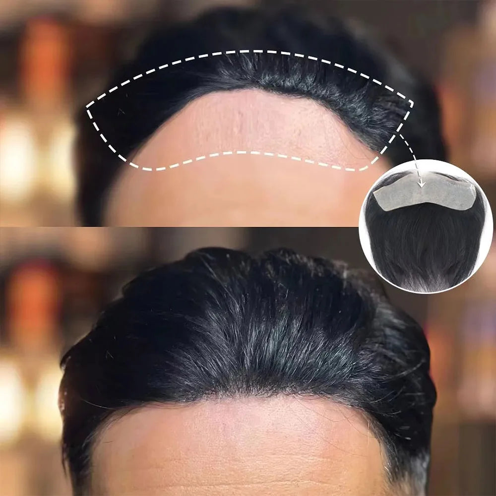 Men's Frontal V-Loop Hairline Patch 0.06mm PU by HitMyNeed