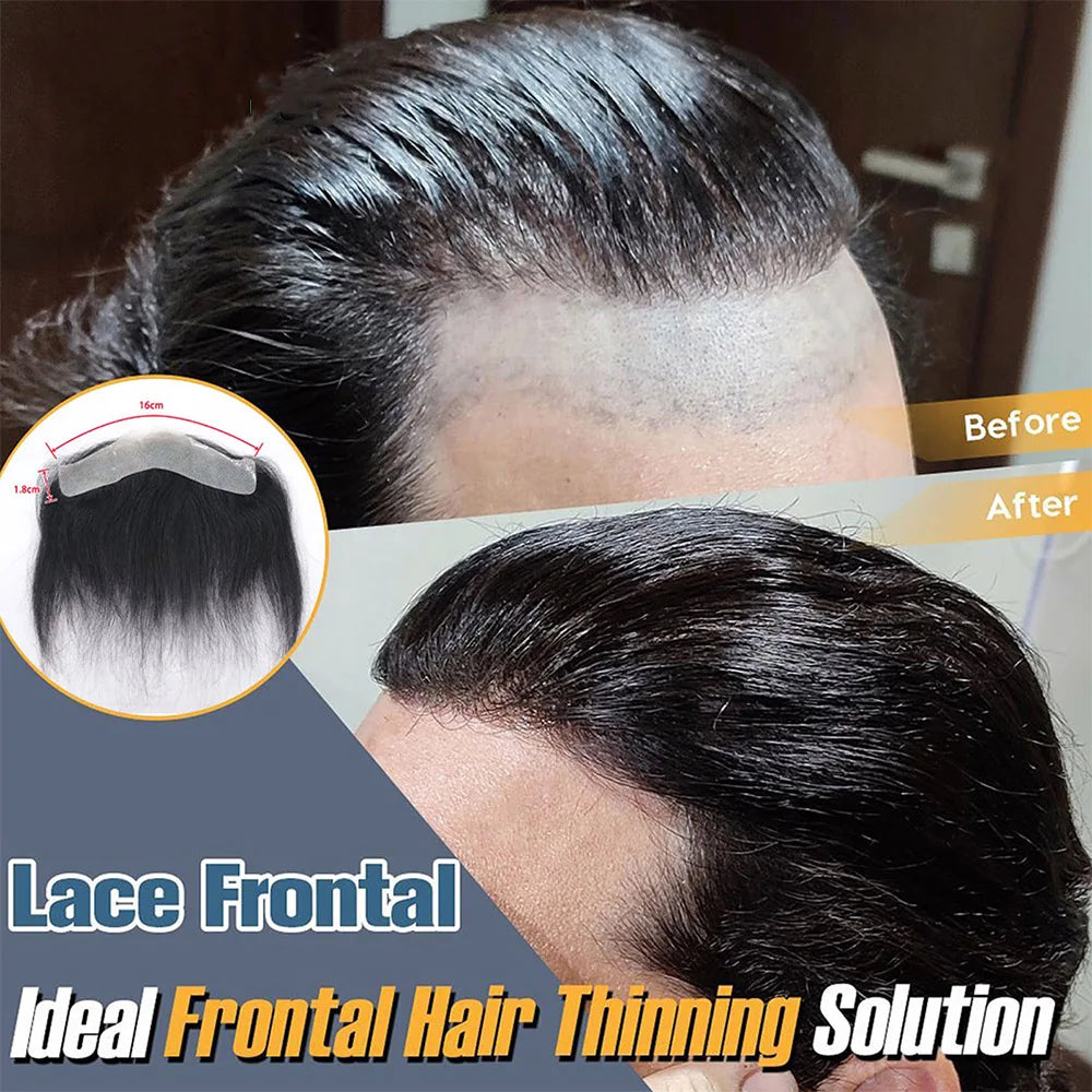 Men's Frontal V-Loop Hairline Patch 0.06mm PU by HitMyNeed