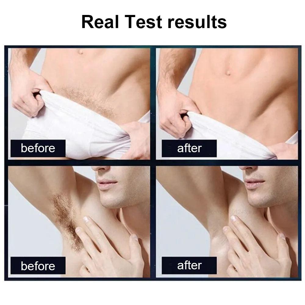 Men's Waterproof Body Trimmer & Epilator IPX7 by HitMyNeed