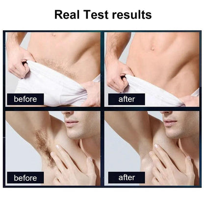 Men's Waterproof Body Trimmer & Epilator IPX7 by HitMyNeed