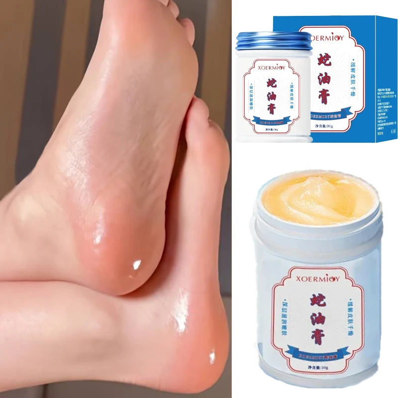 Moisturizing Anti-Crack Foot & Hand Cream 30g by HitMyNeed