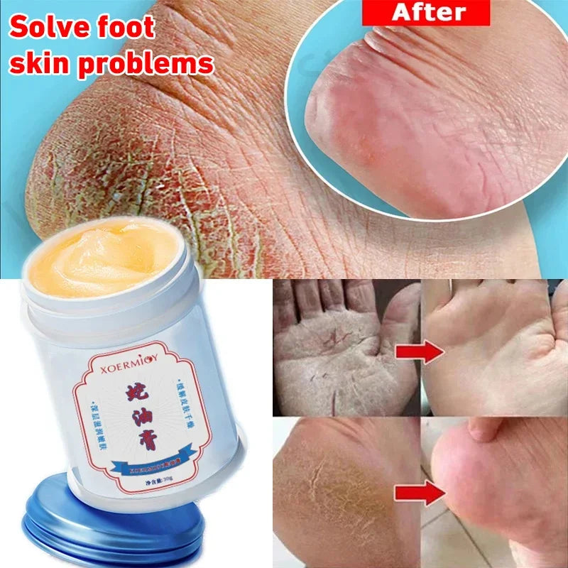 Moisturizing Anti-Crack Foot & Hand Cream 30g by HitMyNeed