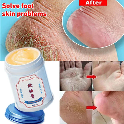 Moisturizing Anti-Crack Foot & Hand Cream 30g by HitMyNeed