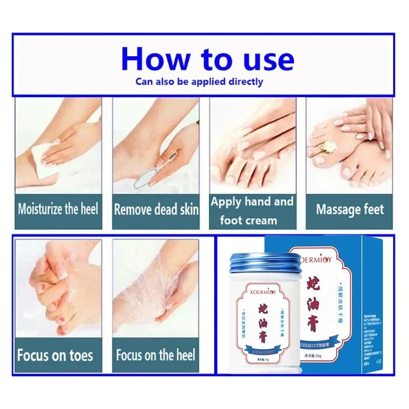Moisturizing Anti-Crack Foot & Hand Cream 30g by HitMyNeed