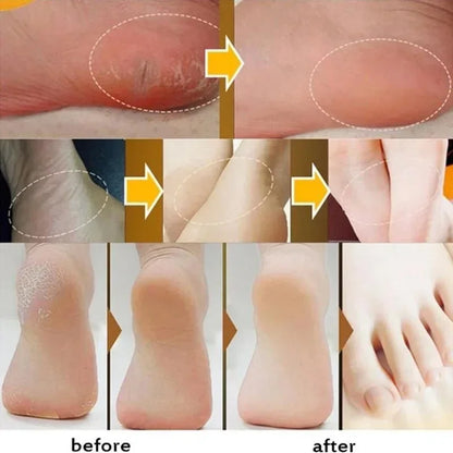 Moisturizing Anti-Crack Foot & Hand Cream 30g by HitMyNeed