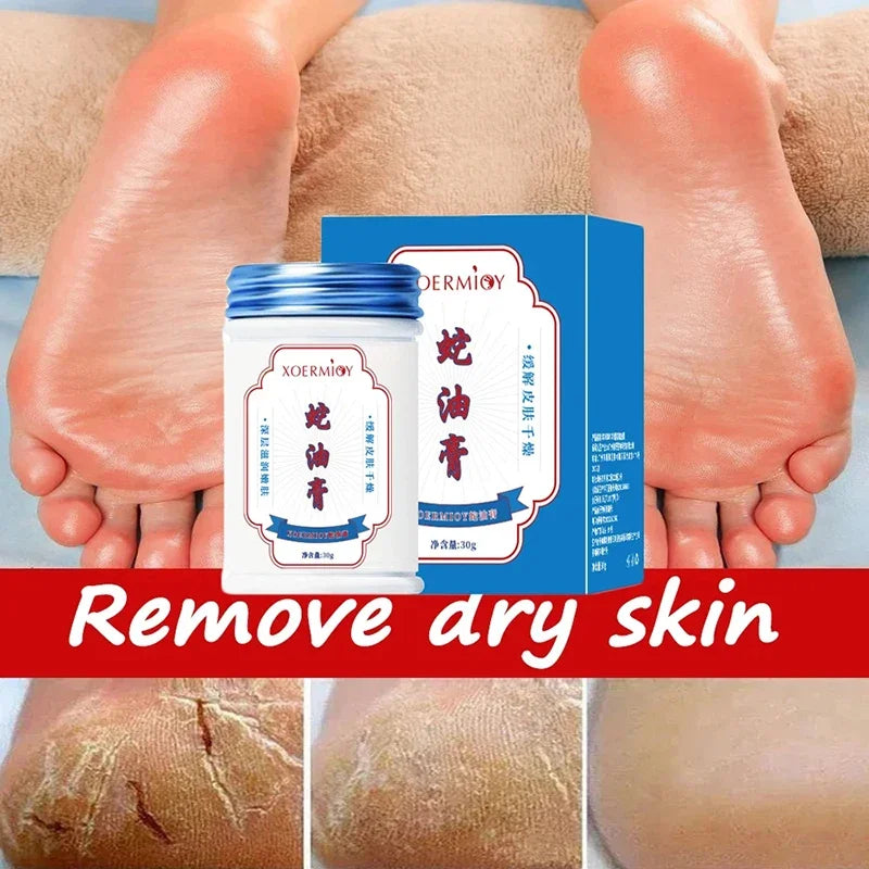 Moisturizing Anti-Crack Foot & Hand Cream 30g by HitMyNeed