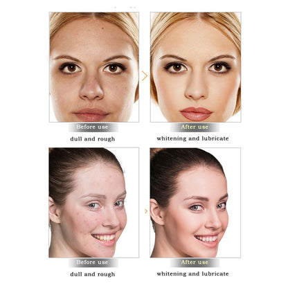 Moisturizing Skin Repair Cream with Snail Extract by HitMyNeed