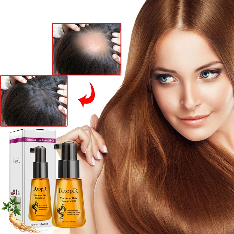 Moroccan Hair Oil Treatment for Dry, Damaged Hair by HitMyNeed