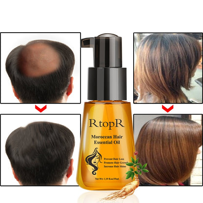 Moroccan Hair Oil Treatment for Dry, Damaged Hair by HitMyNeed