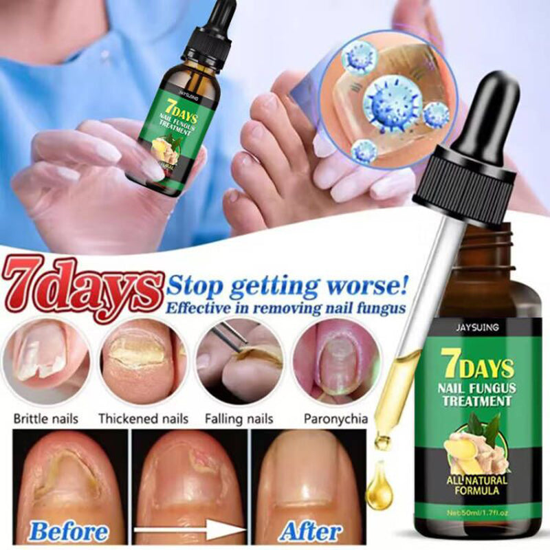 Nail Fungus Treatment Essence Oil 20ml by HitMyNeed