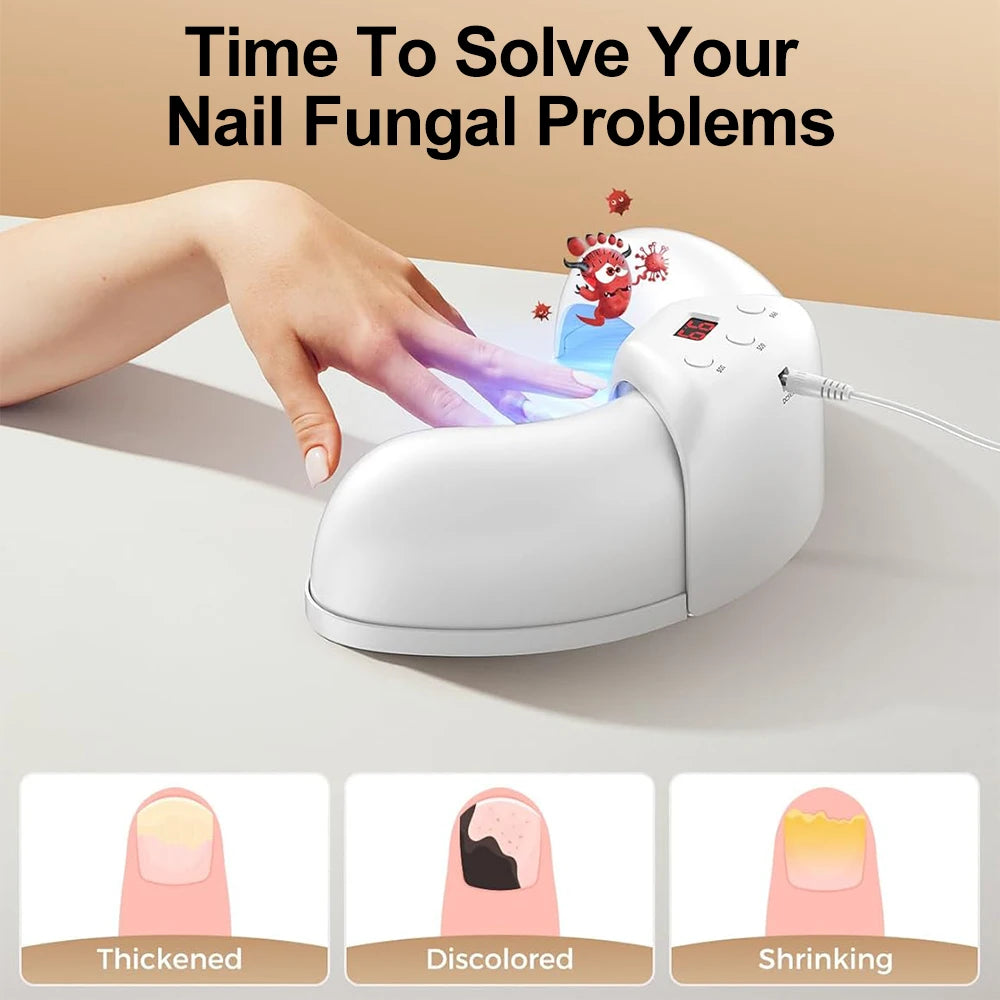 Nail Laser Fungus Device for Hands and Feet by HitMyNeed