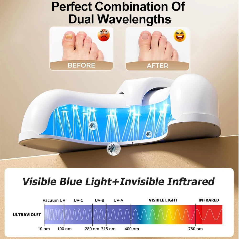 Nail Laser Fungus Device for Hands and Feet by HitMyNeed