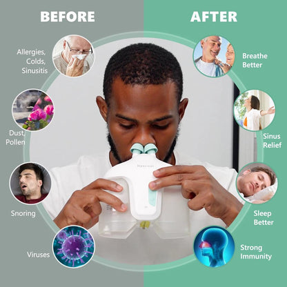 Nascool Electric Nasal Irrigation System with 50 Pods by HitMyNeed