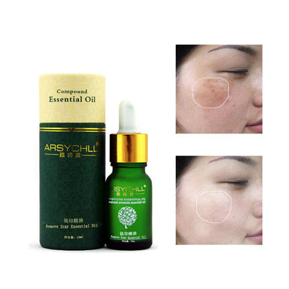 Natural Acne Scar Removal Facial Oil by HitMyNeed