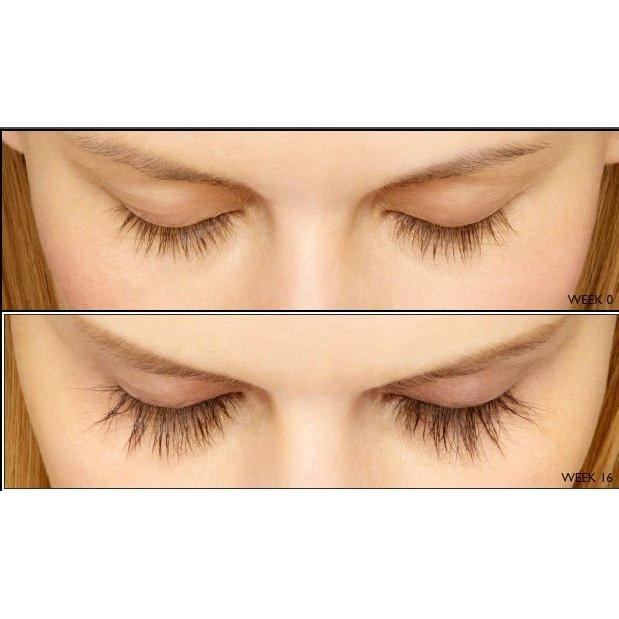 Natural Eyelash Growth Serum Treatment by HitMyNeed