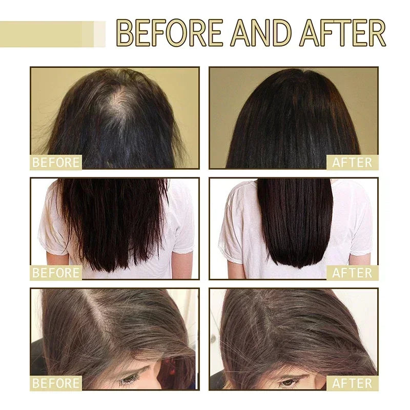Natural Hair Growth Oil for Thicker, Stronger Hair by HitMyNeed