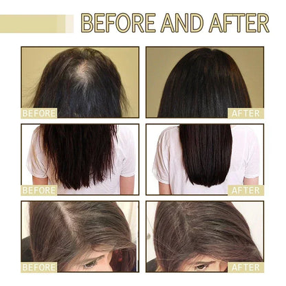 Natural Hair Growth Oil for Thicker, Stronger Hair by HitMyNeed