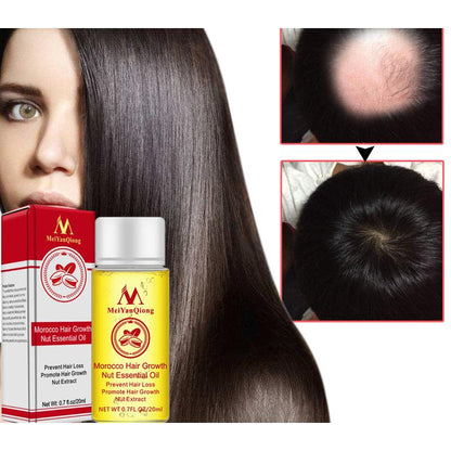 Natural Hair Growth Serum for Thicker, Fuller Hair by HitMyNeed