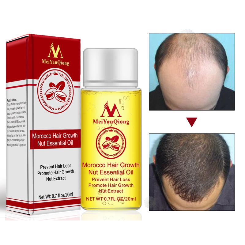 Natural Hair Growth Serum for Thicker, Fuller Hair by HitMyNeed