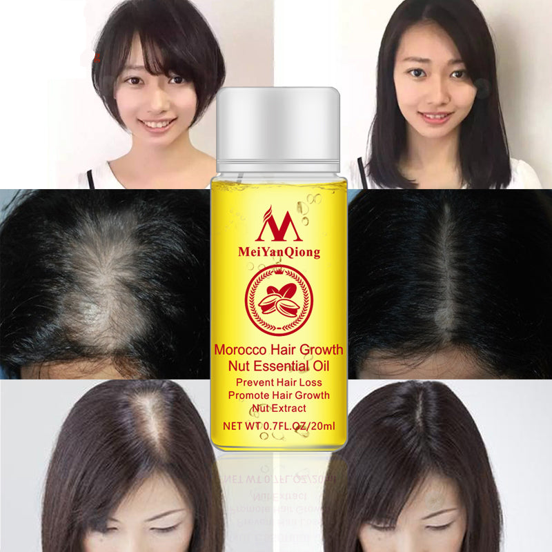 Natural Hair Growth Serum for Thicker, Fuller Hair by HitMyNeed